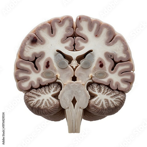 A cross-section of a human brain showcasing internal structures white matter gray matter and cerebellar hemispheres isolated on a pristine white background for study.