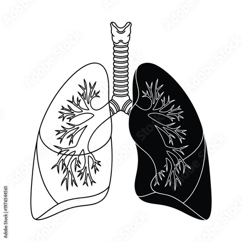 Anatomical illustration of the human lungs and bronchial tree structure