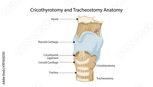 Cricothyrotomy and Tracheostomy Anatomy
laryngeal landmarks for emergency airway procedures including cricothyrotomy and tracheostomy.