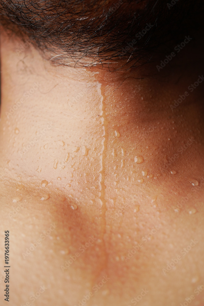 Fototapeta premium Sweat beads on skin after exercise in hot weather conditions,