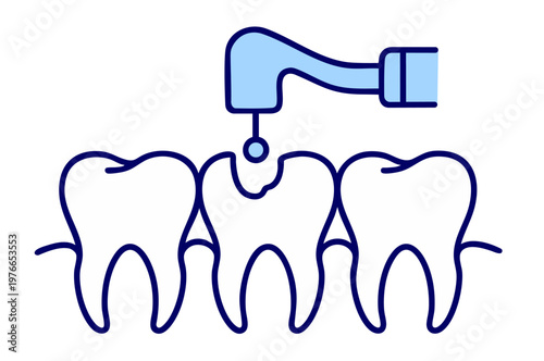 Dental Drill Treating Tooth Decay, Caries Removal and Cavity Preparation Procedure