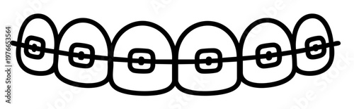 Orthodontic Braces System on Teeth, Metal Brackets and Wire for Smile Correction