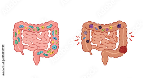 Healthy versus inflamed intestines a comparative illustration of gut health