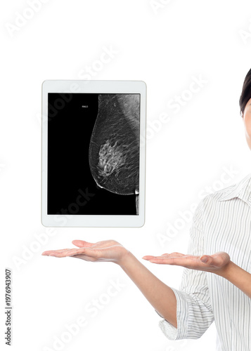 Female medical professional holding tablet displaying lateral breast mammogram MLO view on white background.