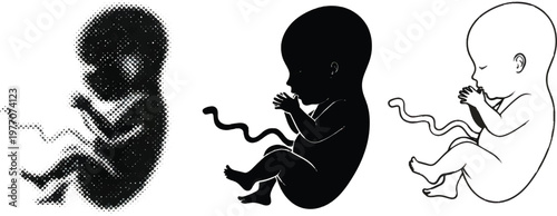 Set of human fetus and embryo silhouettes and line art illustrations representing pregnancy development and medical biology
