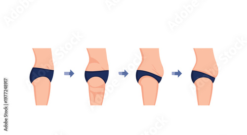 Sequence of four illustrations shows the progression of weight loss and body transformation on a woman's lower torso.
