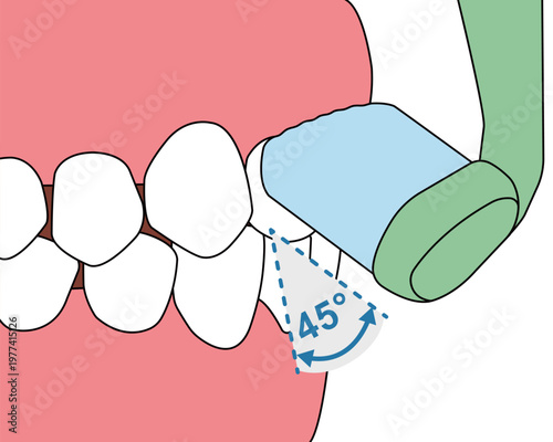 Correct Toothbrushing Technique at 45 Degree Angle on Front Teeth Gum Line