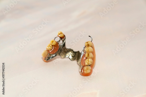 Partial removable dental denture with metal frame and artificial teeth isolated on white background. Macro studio shot. Dental prosthetics and oral healthcare concept.