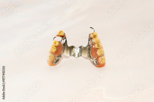 Partial removable dental denture with metal frame and artificial teeth isolated on white background. Macro studio shot. Dental prosthetics and oral healthcare concept.