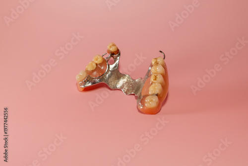 Partial denture with artificial teeth and metal base on pink background. Studio product photography isolated object. Dentistry prosthesis and oral care concept. Design for poster, banner.