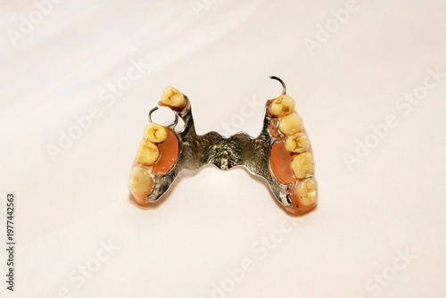 Partial removable dental denture with metal frame and artificial teeth isolated on white background. Macro studio shot. Dental prosthetics and oral healthcare concept.