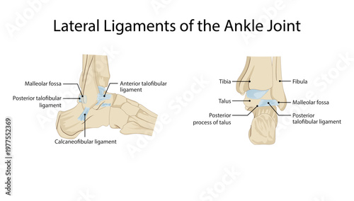 Lateral Ligaments of the Ankle Joint
lateral ankle ligaments including anterior talofibular, calcaneofibular, and posterior talofibular ligaments.