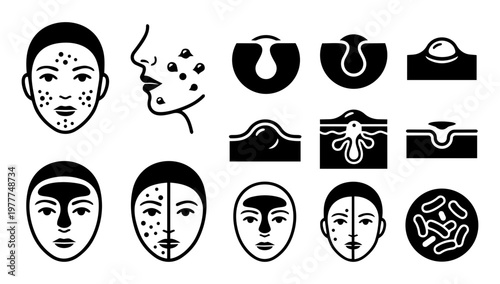 Acne and Skin Condition Silhouettes Dermatology Icons Face Blemish Medical Set