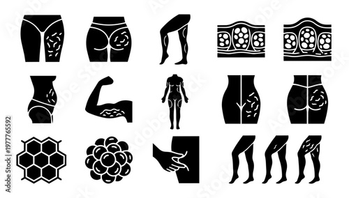 Cellulite Silhouettes Body Skin Texture Icons Aesthetic Treatment Zones Set