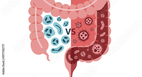 Gut Microbiome Health Versus Disease Illustration.