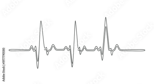 Simple electrocardiogram waveform with prominent peaks and troughs on a white background