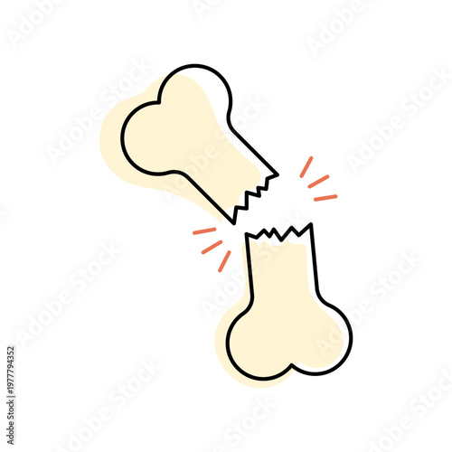 Illustration of a broken bone with red fracture lines on a white background