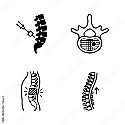 Spine augmentation Icon Set