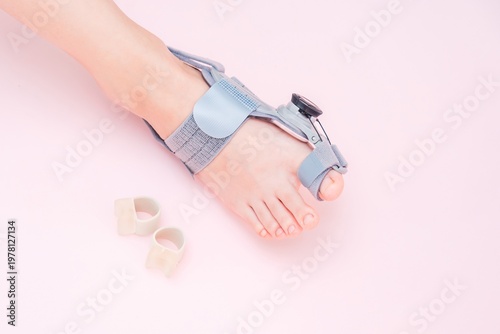 Medical orthopedic bandage and silicone finger separator to treat and prevent Hallux Valgus with adjustment on female foot