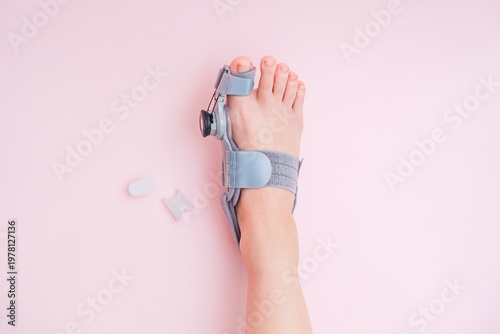 View on hallux valgus orthopedic medical thumb brace on female foot and silicone finger separator