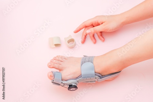 Medical orthopedic bandage and silicone finger separator to treat and prevent Hallux Valgus with adjustment on female foot