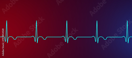 Quadro su tela Subacute stage of myocardial infarction, 3D