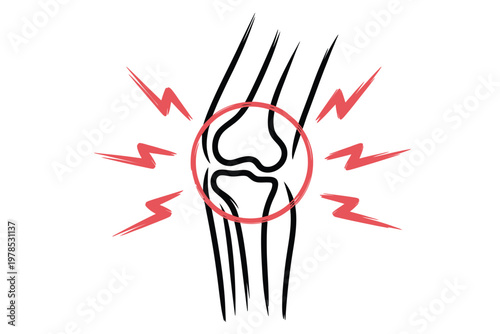 Illustration depicting knee pain with radiating discomfort signified by red lightning bolts
