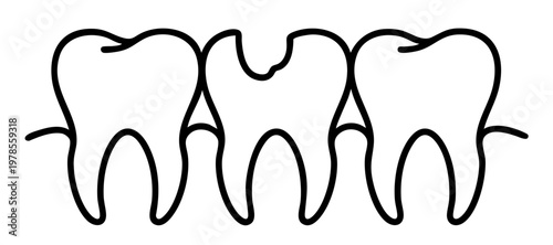 Tooth with Deep Caries Damage and Enamel Chip Occlusal Surface Cavity Dental Problem
