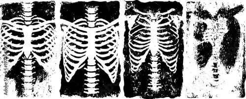 set of four vintage chest x ray showing ribcage and lung details in black and white contrast