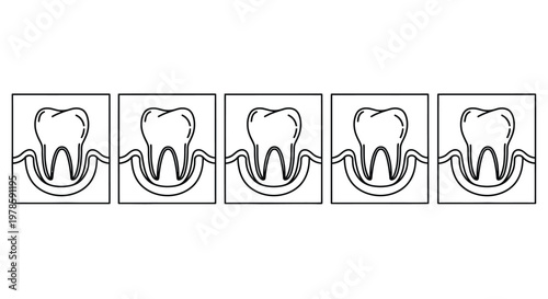 A series of five line drawings depict a tooth and its surrounding bone structure