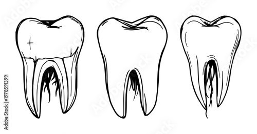 Molar tooth set with sketchy black line art illustration on white background featuring human tooth, roots, enamel with diagram and line art