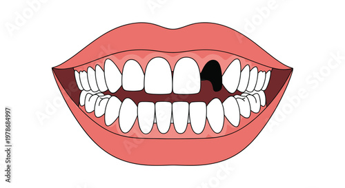 Human mouth with pink lips and white teeth showing a noticeable gap where a single tooth is missing in the upper jaw.