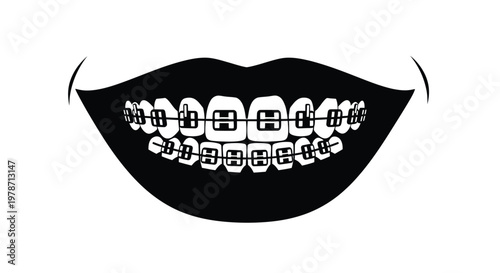Close up of a mouth with braces a striking black silhouette