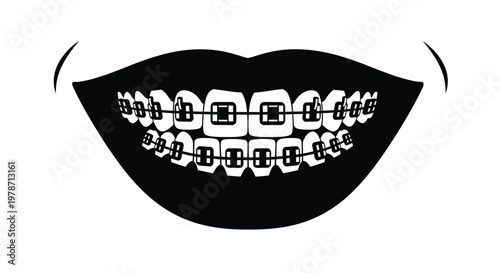 Close up of teeth with braces a striking black and white silhouette