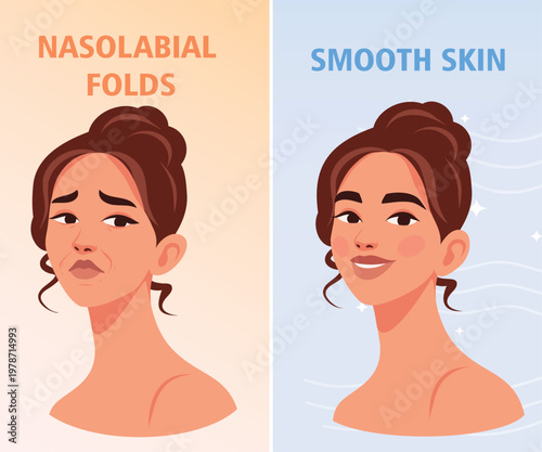 Vector illustration, nasolabial folds before, after. Woman with wrinkles, nasolabial folds in another portrait is woman with smoothed, fresh skin. For advertising skin care products, cosmetics, beauty
