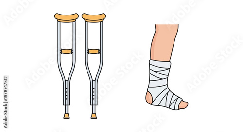 Crutches and bandaged foot injury recovery.