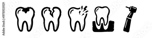 Set of Hand Drawn Dental Health Icons Featuring Tooth Decay Cracked Molar Severe Toothache Healthy Tooth in Gum and Dentist Drill Handpiece on White Background
