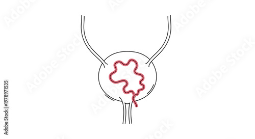 Abstract representation of a convoluted tube within the bladder, symbolizing a medical condition or anatomical feature