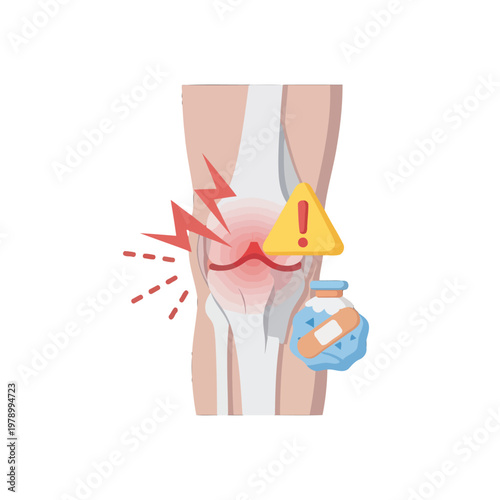 A medical illustration showing a painful human knee joint with inflammation