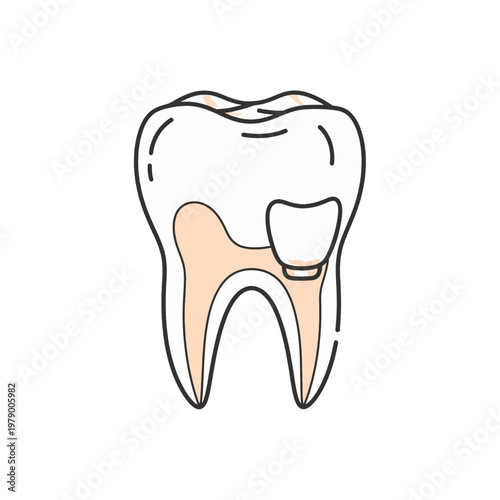 A simple line art illustration of a human tooth with a dental filling