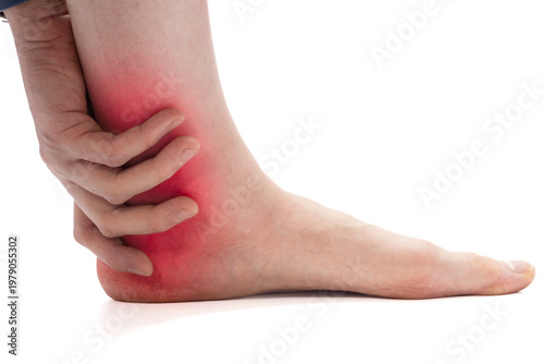 Slika na platnu Plantar Fasciitis Heel Pain Concept