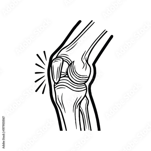 Painful knee joint with inflamed tendons and ligaments