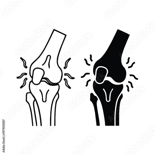 Knee joint pain comparison with and without inflammation
