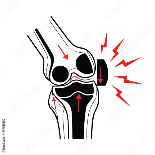 Knee joint pain and inflammation illustration