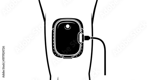 Medical Device Attached to Leg for Treatment