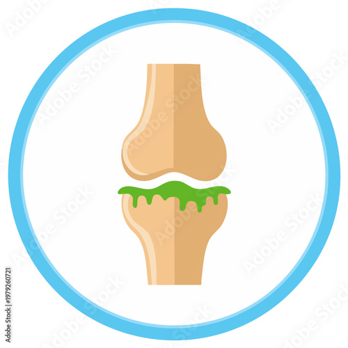 Human Knee Joint with Green Fluid Inside Round Blue Frame Anatomy Illustration