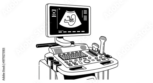 Ultrasound machine with monitor screen.