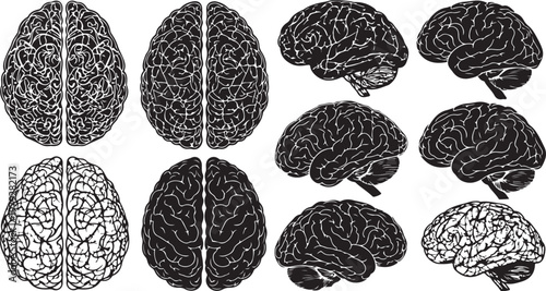 Illustrations of human brain anatomy from various angles shown