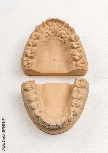 Wallpaper Mural Dental plaster models studying jaw and teeth anatomy Torontodigital.ca