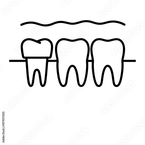 Vector of three teeth with one tooth capped